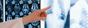 Understanding Lung Squeeze